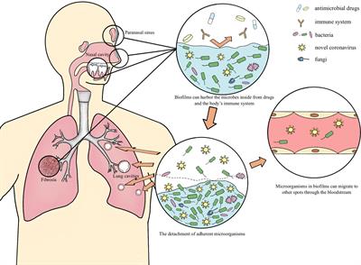 Biofilms possibly harbor occult SARS-CoV-2 may explain lung cavity, re-positive and long-term positive results